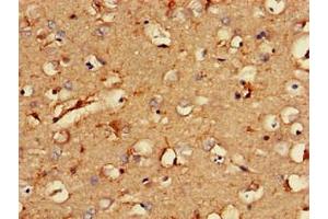 Immunohistochemistry of paraffin-embedded human brain tissue using ABIN7146282 at dilution of 1:100 (RCAN2 抗体  (AA 88-197))