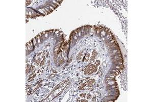 Immunohistochemical staining of human bronchus with C11orf60 polyclonal antibody  shows moderate cytoplasmic and membrane positivity in respiratory epithelial cells at 1:500-1:1000 dilution. (IFT46 抗体)