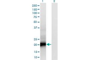 Western Blot analysis of SMUG1 expression in transfected 293T cell line by SMUG1 monoclonal antibody (M07), clone 4D5. (SMUG1 抗体  (AA 1-177))