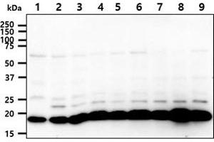 The cell lysates (40ug) were resolved by SDS-PAGE, transferred to PVDF membrane and probed with anti-human SSU72 antibody (1:1000). (SSU72 抗体)