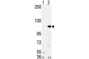Western blot analysis of LSD1 antibody and 293 cell lysate either nontransfected (Lane 1) or transiently transfected with the AOF2/LSD1 gene (2). (LSD1 抗体  (AA 108-142))