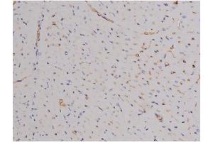 ABIN6267606 at 1/200 staining Mouse heart tissue sections by IHC-P.