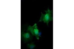 Image no. 4 for anti-HRas proto-oncogene, GTPase (HRAS) antibody (ABIN1498716) (HRAS 抗体)