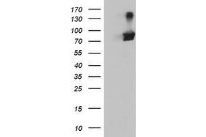 Western Blotting (WB) image for anti-Arginyl Aminopeptidase (Aminopeptidase B) (RNPEP) antibody (ABIN1500729)