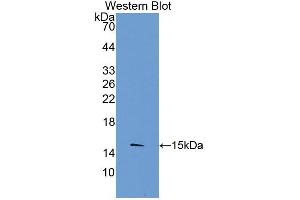 Rabbit Capture antibody from the kit in WB with Positive Control: Mouse Spleen lysate. (TLR3 ELISA 试剂盒)