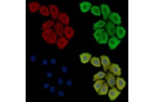 ABIN6260161 and ABIN6279063 staining Hela cells by IF/ICC. (AWAT2 抗体  (Internal Region))