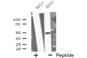 Western blot analysis of extracts from HeLa cells using GORASP2 antibody. (GORASP2 抗体  (Internal Region))