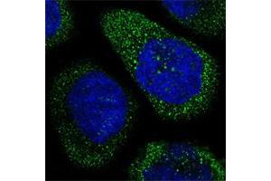 Immunofluorescent staining of human cell line A-431 shows positivity in cytoplasm. (THSD1 抗体)