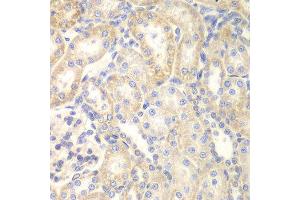 Immunohistochemistry (IHC) image for anti-Deleted in Liver Cancer 1 (DLC1) (AA 204-463) antibody (ABIN3015711) (DLC1 抗体  (AA 204-463))