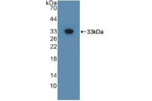 Detection of Recombinant GPC3, Mouse using Polyclonal Antibody to Glypican 3 (GPC3) (Glypican 3 抗体  (AA 344-559))