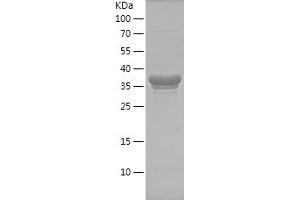 EEF1A2 Protein (AA 373-463) (His-IF2DI Tag)