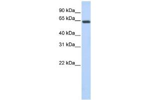 UPF3B antibody used at 1 ug/ml to detect target protein. (UPF3B 抗体)