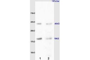 L1 rat kidney lysates L2 rat liver lysates probed with Anti RCL/c Myc responsive Polyclonal Antibody, Unconjugated (ABIN872485) at 1:200 overnight at 4 °C. (RCL 抗体  (AA 101-174))