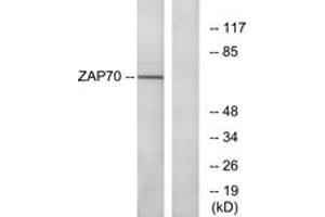 Western blot analysis of extracts from Jurkat cells, using ZAP-70 (Ab-319) Antibody. (ZAP70 抗体  (AA 286-335))