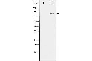Western blot analysis of FGFR1 phosphorylation expression in EGF treated HepG2 whole cell lysates,The lane on the left is treated with the antigen-specific peptide. (FGFR1 抗体  (pTyr766))