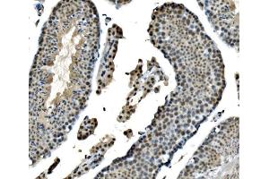 IHC analysis of LSM8 using anti-LSM8 antibody (ABIN7599579). (NAA38 抗体  (AA 1-96))