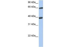 WB Suggested Anti-TKT  Antibody Titration: 0. (TKT 抗体  (N-Term))