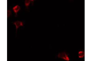 ABIN6274863 staining HeLa by IF/ICC. (ARG2 抗体  (C-Term))