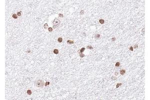 ABIN6268816 at 1/100 staining human brain tissue sections by IHC-P.