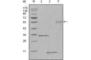 Western blot analysis using Ki67 mouse mAb against truncated Trx-Ki67 recombinant protein(1),truncated Ki67 (aa3118-3256)-His recombinant protein(2) and truncated Ki67 (aa3118-3256)-hIgGFc transfected CHO-K1 cell lysate(3). (Ki-67 抗体  (AA 3118-3256))