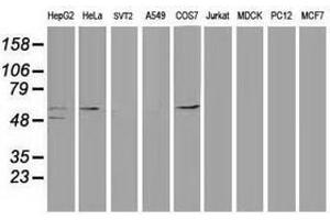Image no. 3 for anti-Tumor Protein P53 (TP53) antibody (ABIN1499969) (p53 抗体)