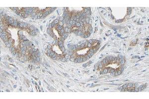 ABIN6276506 at 1/100 staining Human prostate tissue by IHC-P. (Thymidine Phosphorylase 抗体  (N-Term))
