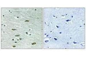 Immunohistochemistry analysis of paraffin-embedded human brain tissue using IGF1R (Ab-1346) antibody. (IGF1R 抗体  (Tyr1346))