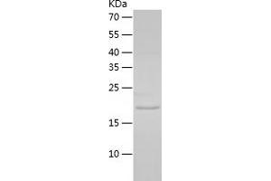 Cardiotrophin 1 (CTF1) (AA 1-203) protein (His-IF2DI Tag)