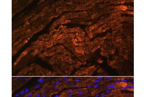 Immunofluorescence analysis of Rat heart using TTN Polyclonal Antibody at dilution of 1:100. (Titin 抗体)