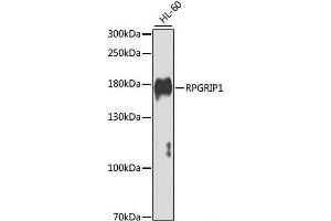 Western blot analysis of extracts of HL-60 cells using RPGRIP1 Polyclonal Antibody at dilution of 1:1000. (RPGRIP1 抗体)