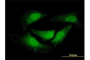 Immunofluorescence of monoclonal antibody to NR0B1 on HeLa cell. (NR0B1 抗体  (AA 361-470))