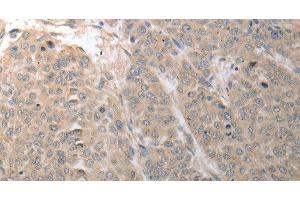 Immunohistochemistry (Paraffin-embedded Sections) (IHC (p)) image for anti-Solute Carrier Family 1 (Glutamate/Neutral Amino Acid Transporter), Member 4 (SLC1A4) antibody (ABIN7242419)