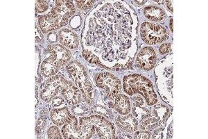 Immunohistochemical staining of human kidney with WNK4 polyclonal antibody ( Cat # PAB28012 ) shows strong cytoplasmic and nuclear positivity in cells in tubules at 1:20 - 1:50 dilution. (WNK4 抗体)