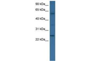 Image no. 1 for anti-Bone Morphogenetic Protein 6 (BMP6) (AA 46-95) antibody (ABIN6746538) (BMP6 抗体  (AA 46-95))