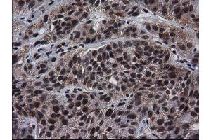 Image no. 1 for anti-Nonhomologous End-Joining Factor 1 (NHEJ1) antibody (ABIN1499728) (NHEJ1 抗体)