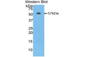 Western blot analysis of the recombinant protein. (Fibrinogen beta Chain 抗体  (AA 49-495))