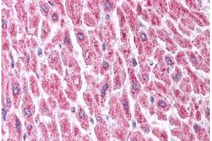Human Heart (formalin-fixed, paraffin-embedded) stained with HDAC8 antibody ABIN214773 at 5 ug/ml followed by biotinylated goat anti-rabbit IgG secondary antibody ABIN481713, alkaline phosphatase-streptavidin and chromogen. (HDAC8 抗体  (C-Term))