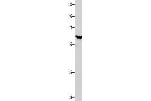 Western Blotting (WB) image for anti-DnaJ (Hsp40) Homolog, Subfamily C, Member 7 (DNAJC7) antibody (ABIN2421969) (DNAJC7 抗体)