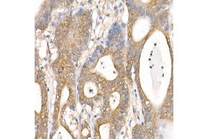 Immunohistochemistry (IHC) image for anti-Catenin (Cadherin-Associated Protein), beta 1, 88kDa (CTNNB1) antibody (ABIN7266138)