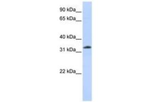 Image no. 1 for anti-Siah E3 Ubiquitin Protein Ligase 2 (SIAH2) (N-Term) antibody (ABIN6744237) (SIAH2 抗体  (N-Term))