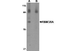 Western Blotting (WB) image for anti-Epithelial Splicing Regulatory Protein 1 (ESRP1) (N-Term) antibody (ABIN1031534) (ESRP1 抗体  (N-Term))