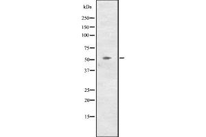 Western blot analysis of CCNL2 expression in NCI-H460 cell line lysates ,The lane on the left is treated with the antigen-specific peptide. (Cyclin L2 抗体  (C-Term))