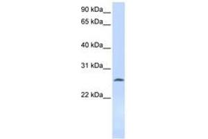Image no. 1 for anti-Deoxycytidine Kinase (DCK) (AA 108-157) antibody (ABIN6743592) (DCK 抗体  (AA 108-157))