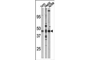 Image no. 2 for anti-E2F Transcription Factor 1 (E2F1) (pSer337) antibody (ABIN358119) (E2F1 抗体  (pSer337))