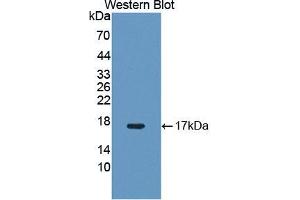 Western blot analysis of the recombinant protein. (NR4A3 抗体  (AA 29-145))