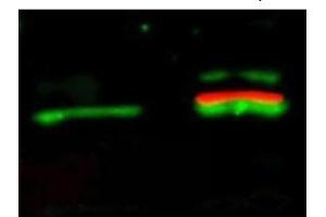 Immunofluorescence (IF) image for anti-V-Akt Murine Thymoma Viral Oncogene Homolog 1 (AKT1) (Ser473) antibody (ABIN400784) (AKT1 抗体  (Ser473))