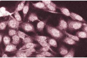 Immunofluorescence staining of HeLa cells. (CTNNA1 抗体  (AA 729-906))