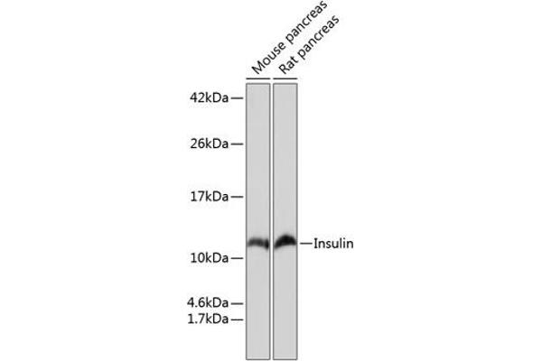 Insulin 抗体