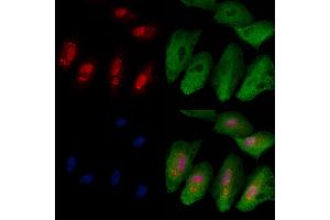 ABIN6263540 and ABIN6279810 staining  cells by IF/ICC. (NCKIPSD 抗体  (Internal Region))