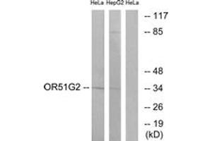 Western blot analysis of extracts from HeLa/HepG2 cells, using OR51G2 Antibody. (OR51G2 抗体  (AA 211-260))